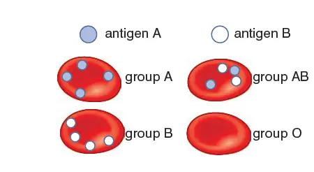 The ABO blood groups with the antigen  presence/absence